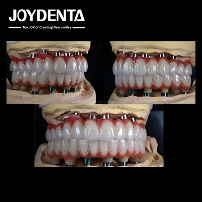 kupować 10 mm Implant zębów wielopłaszczyznowych z tytanu produkcja online