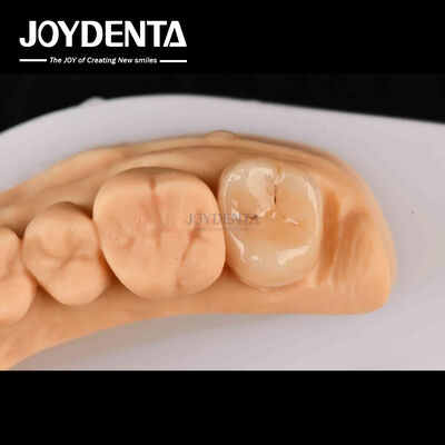 kupować Wysokiej wytrzymałości Emax Inlay Onlay A2 Długotrwały kolor do odbudowy uszkodzonych zębów produkcja online