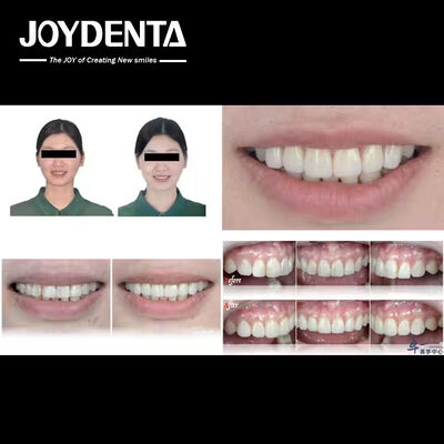 kupować Popularne produkty Joydentalab: symulowane fałdy estetyczne produkcja online