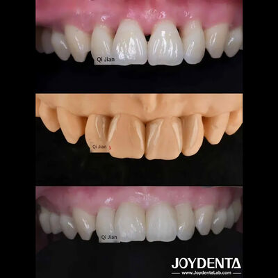 kupować Feniery z grzybów - doskonałe rozwiązanie dla naturalnych przezroczystych fenierów produkcja online