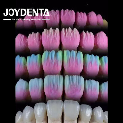 kupować The Joydenta Ceramic Veneer Process produkcja online