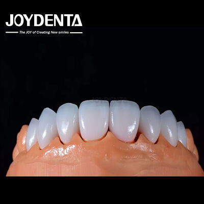 kupować A1-A4 Ips Emax Press Porcelanowe finery dentystyczne Odporne na plamy Kształt dostosowywalny produkcja online