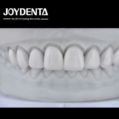 kupować Visualize the Result, Secure the Case: Our Diagnostic Wax-Up Service produkcja online