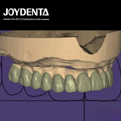 kupować Indywidualizowany projekt cyfrowy diagnostyczny Wax Up Lab Oprogramowanie Bezproblemowa integracja produkcja online
