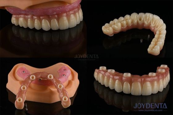 Ivoclar Implant Ball Attachments Wymienny materiał do implantów dentystycznych do higieny jamy ustnej