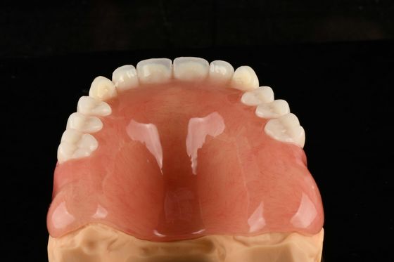 Naturalnie wyglądające zęby z akrylu Zęby sztuczne z akrylu dla długotrwałego komfortu