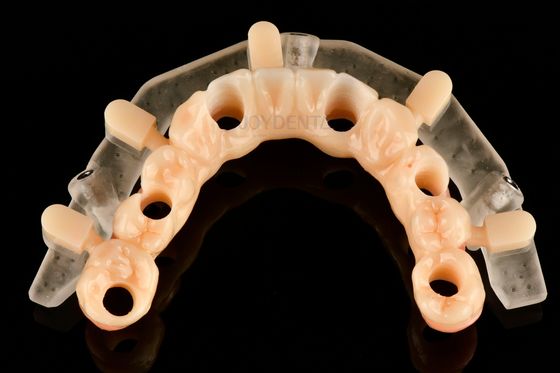 Niestandardowe precyzyjne drukowane w 3D szablony chirurgii prowadzonej do dokładnego umieszczenia implantów