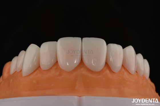 Optymalny komfort pacjenta z porcelanowymi foliami Biokompatybilne i delikatne na tkankach ustnych