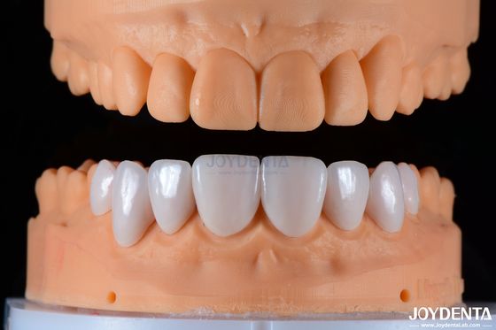 Bezpieczne podszewki porcelanowe Ceramiczne i naturalne estetyczne z silną przyczepnością