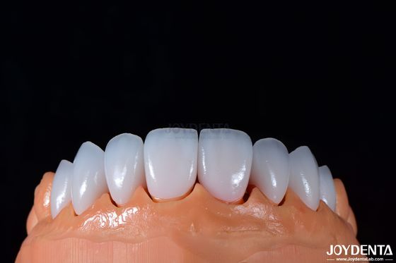 00,3-0,5 mm grubość Emax Porcelanowa folia do stomatologii kosmetycznej o wysokim połysku