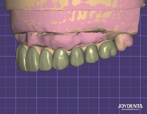 Zgodne z HIPAA bezpieczeństwo danych cyfrowy model 3D do modyfikacji zębów