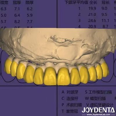 Oprogramowanie do projektowania stomatologicznego cyfrowy wosk z zgodnym z HIPAA bezpieczeństwem danych