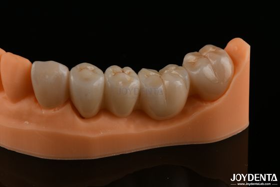 Precyzyjne odbudowy zębów Zirkonia pełna Wysoka wytrzymałość gięciowa Naturalny kolor