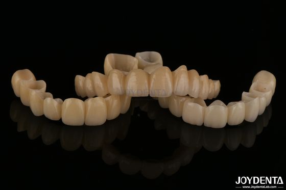 Naturalnie wyglądające porcelanowe mosty z zirkonia, odporne na zużycie, wysoka zgodność biologiczna