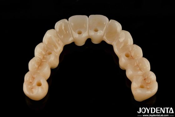 Wysoka elastyczność Zirconia Hybrid Bridge z titaniową podstawą Wysoka estetyka