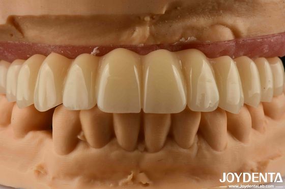 Roztwór stomatologiczny Ti-Base Zirconia Hybrid Bridge Wysoka biokompatybilność Naturalny wygląd