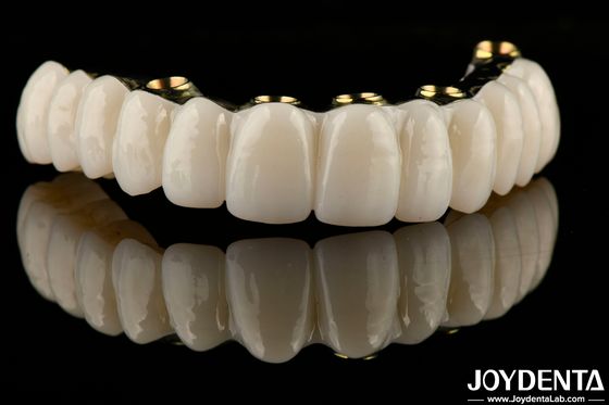 Gładki hybrydowy most implantu z cyrkonii przywracający funkcję żucia
