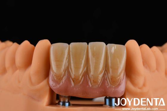 4.5 mm Wysokość Wykończone poduszki Wewnętrzne połączenie sześciokątne Typ kompatybilny z systemami implantów