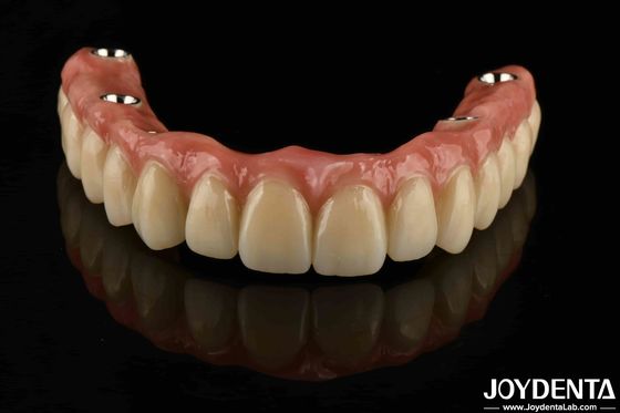 Niestandardowy Titanium Malong Dental Hybrid Bridge odporność na korozję regulowana