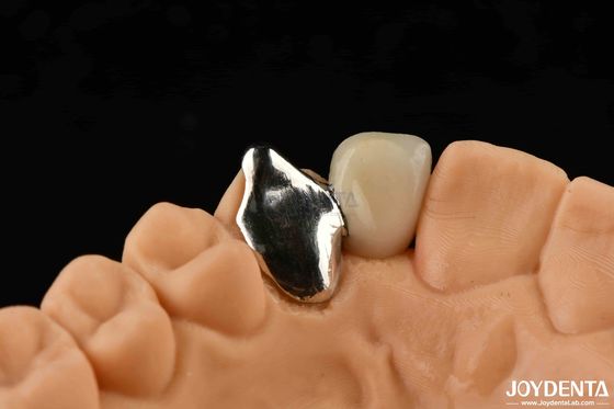 Zastosowalny materiał metalowy PFM Maryland Dental Care Oral Clinical Repair