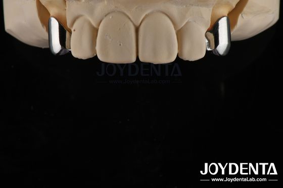 Precyzyjna zdejmowalna proteza implant zębowy