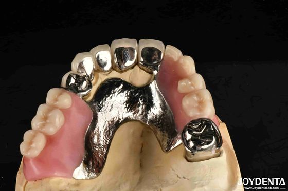 Wypracowanie ramy ostateczny zestaw stabilna struktura dentystyczna zaprojektowane zęby wykończenie