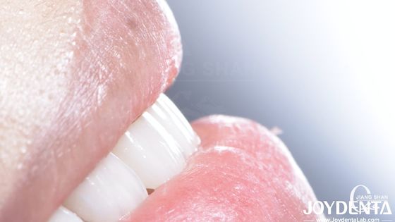 Długotrwałe zębowe kompozytowe wino dobre biokompatybilność bez opadów wino porcelanowe