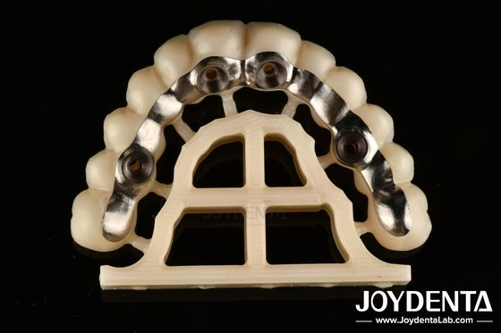 Srebrowy wykończenie na zamówienie Abutments And Bars Precise Fit Screw Retained Or Cement Retained