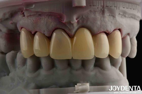 CAD CAM Przetwarzanie zębów PMMA Materiał wielowarstwowy projekt dla naturalnych przejść cienia