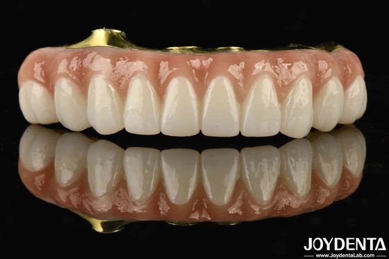 Titanium i cyrkonia Komfort Komfortowy w noszeniu Ti-Bar Zirkonia Hybrid Bridge do zastąpienia brakujących zębów