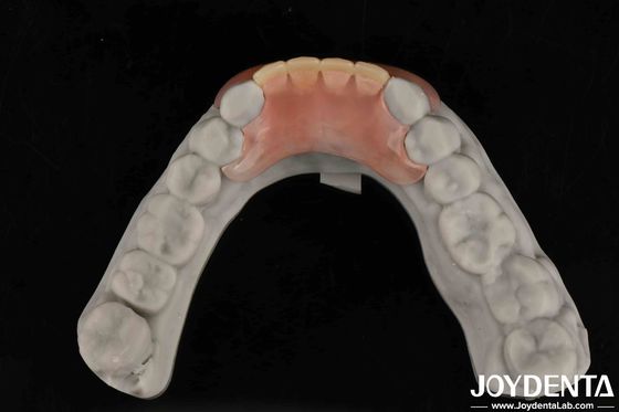 Wprowadź swoją praktykę dentystyczną na nowy poziom elastyczna proteza z naturalną morfologią zębów i spersonalizowana personalizacja