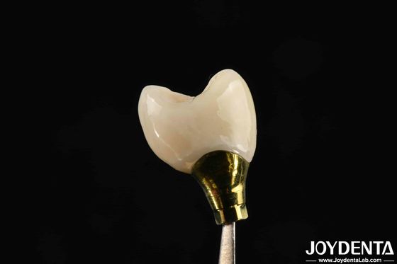 Różne rozmiary Implant Korona i most dla silnych implantów zębowych Kompatybilność