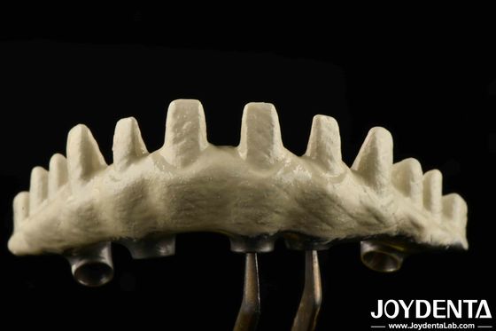 Wewnętrzny typ połączenia sześciokątnego Custom Abutments implantu piaszczyste i kwasu grawerowane dla lepszego dopasowania