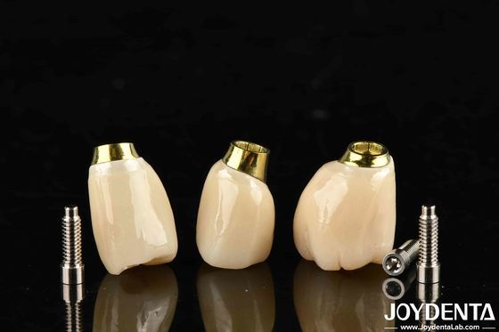 Wysoka wytrzymałość Białym wykończeniem Implant Korona i mostek Z dokładnym dopasowaniem