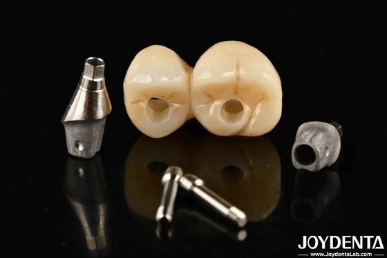 Zastosowalny porcelanowy implant stomatologiczny z pompą i koroną dla wyjątkowej estetyki