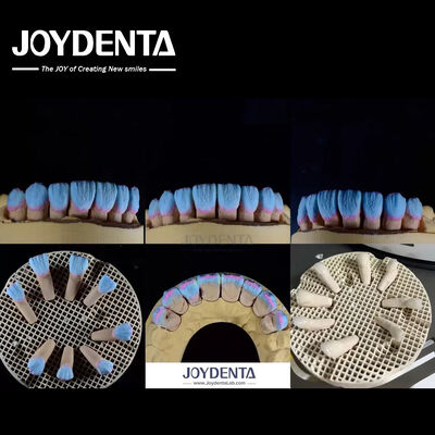 Wysoka biokompatybilność Glossy Feldspatic Ceramic Veneer For Dental Restorations